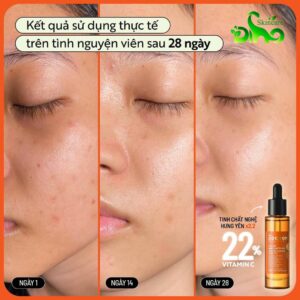 Serum nghệ hưng yên Cocoon với 22% VitC hiệu quả trong 28 ngày sử dụng