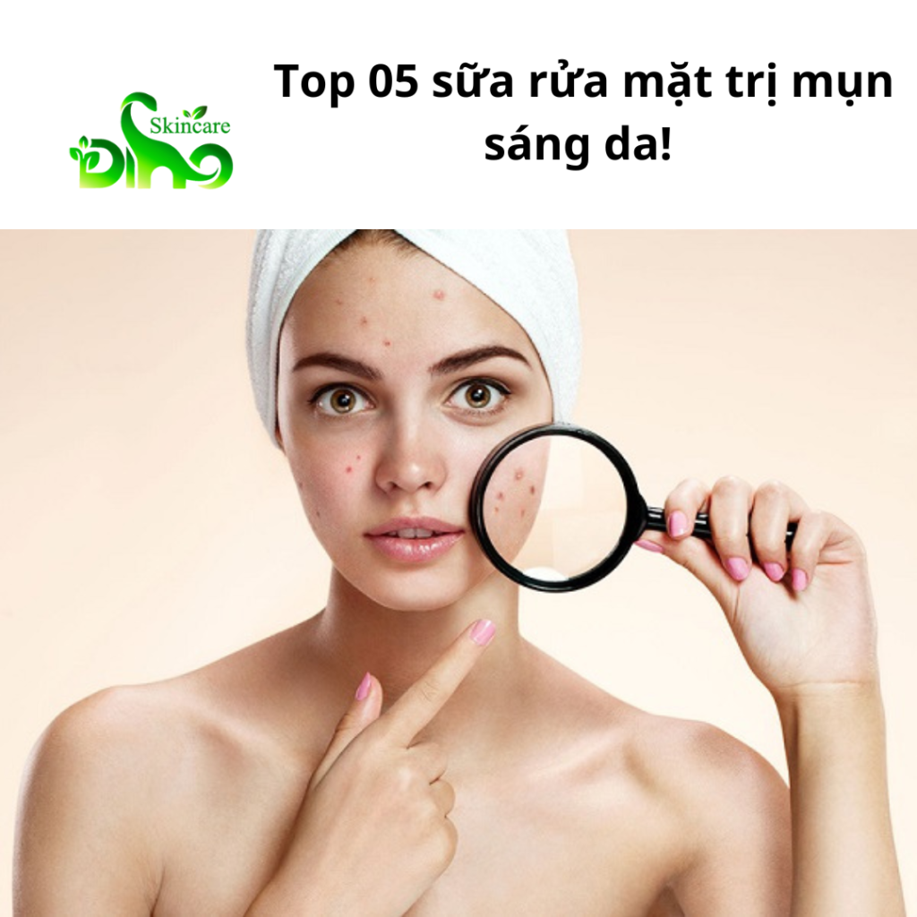 Top 05 sữa rửa mặt trị mụn sáng da